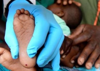Sédhiou : 66 enfants porteurs du VIH/SIDA