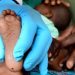 Sédhiou : 66 enfants porteurs du VIH/SIDA